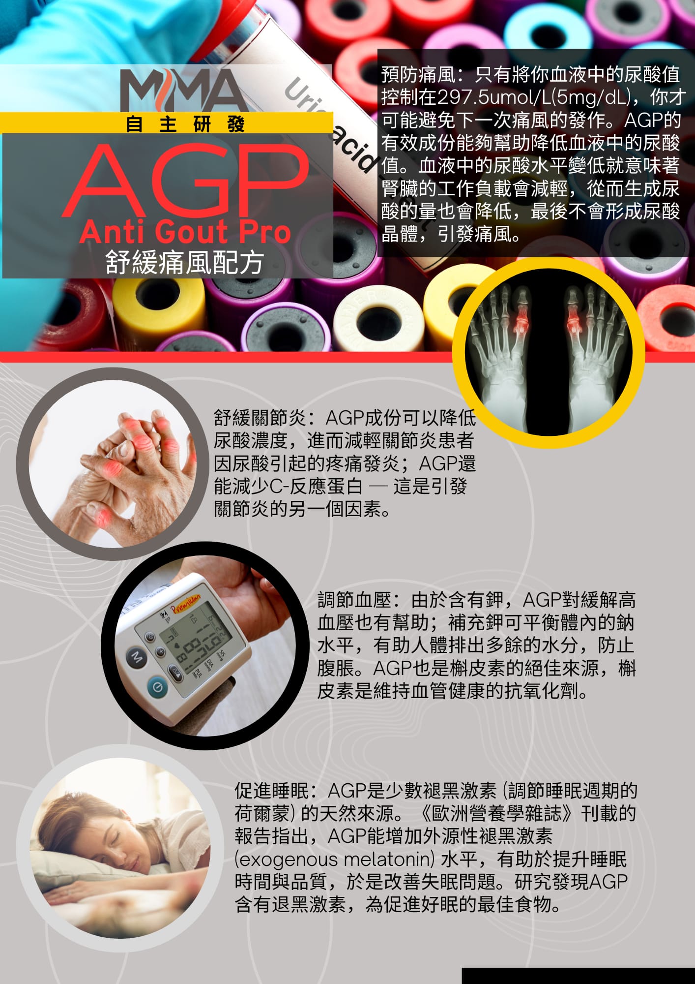 AGP2